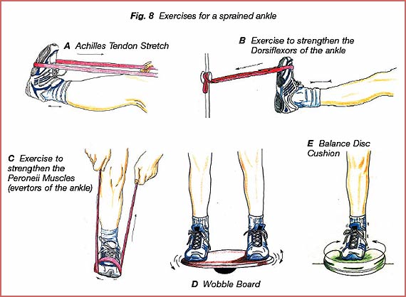 inversion ankle sprain. Treatment for an Ankle Sprain